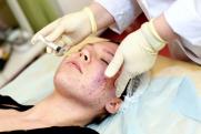 Как работа желудка влияет на кожу: ответ гастроэнтеролога