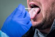 Терапевт назвал неприметный симптом на языке, указывающий на цирроз печени