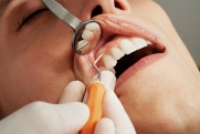 Стоматолог перечислила признаки старения зубов
