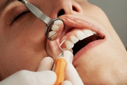 Стоматолог объяснила, почему после профессиональной чистки зубы становятся подвижными