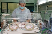 «Это выкидыш, а не ребенок»: зачем врачи выхаживают глубоко недоношенных детей