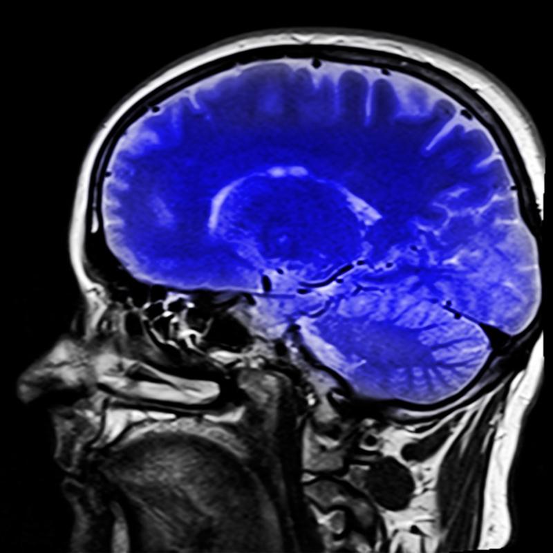 Неврологи рассказали, как отсрочить старение мозга
