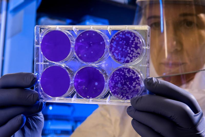 На Ямале провели первые лабораторные исследования на определение коронавируса