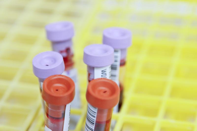 Ученые разработали тест для определения антител к коронавирусу по капле крови