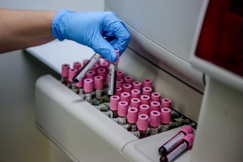 Для анализа на антитела к ковиду у пациентов забирают кровь из вены