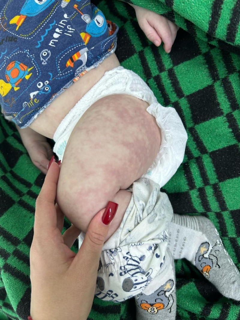 Семимесячный малыш умер, так и не получив помощи врачей