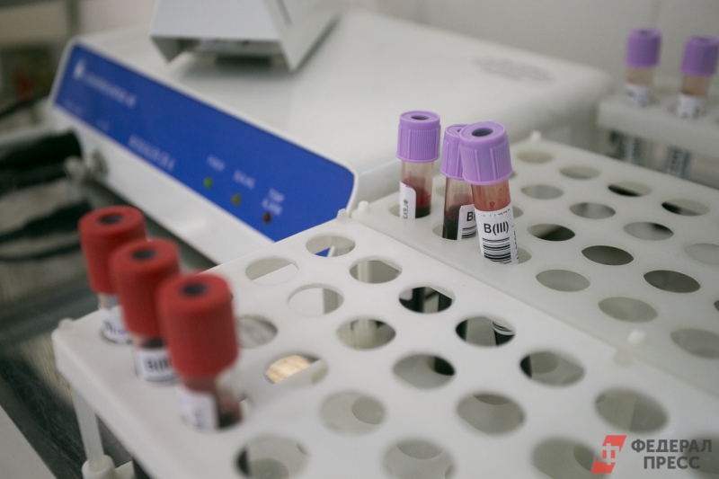 Медики призывают всех свердловчан пройти тестирование на ВИЧ