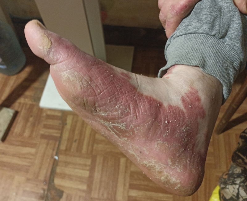 Я думаю, это реакция организма на стресс. Когда ты стоишь, разговариваешь с человеком, а отходишь на 15 метров, поворачиваешь голову и видишь, как его разрывает на куски