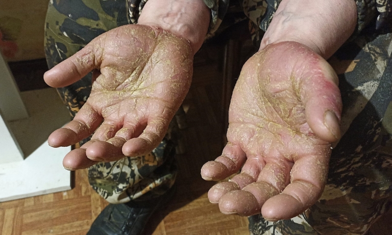 Я думаю, это реакция организма на стресс. Когда ты стоишь, разговариваешь с человеком, а отходишь на 15 метров, поворачиваешь голову и видишь, как его разрывает на куски